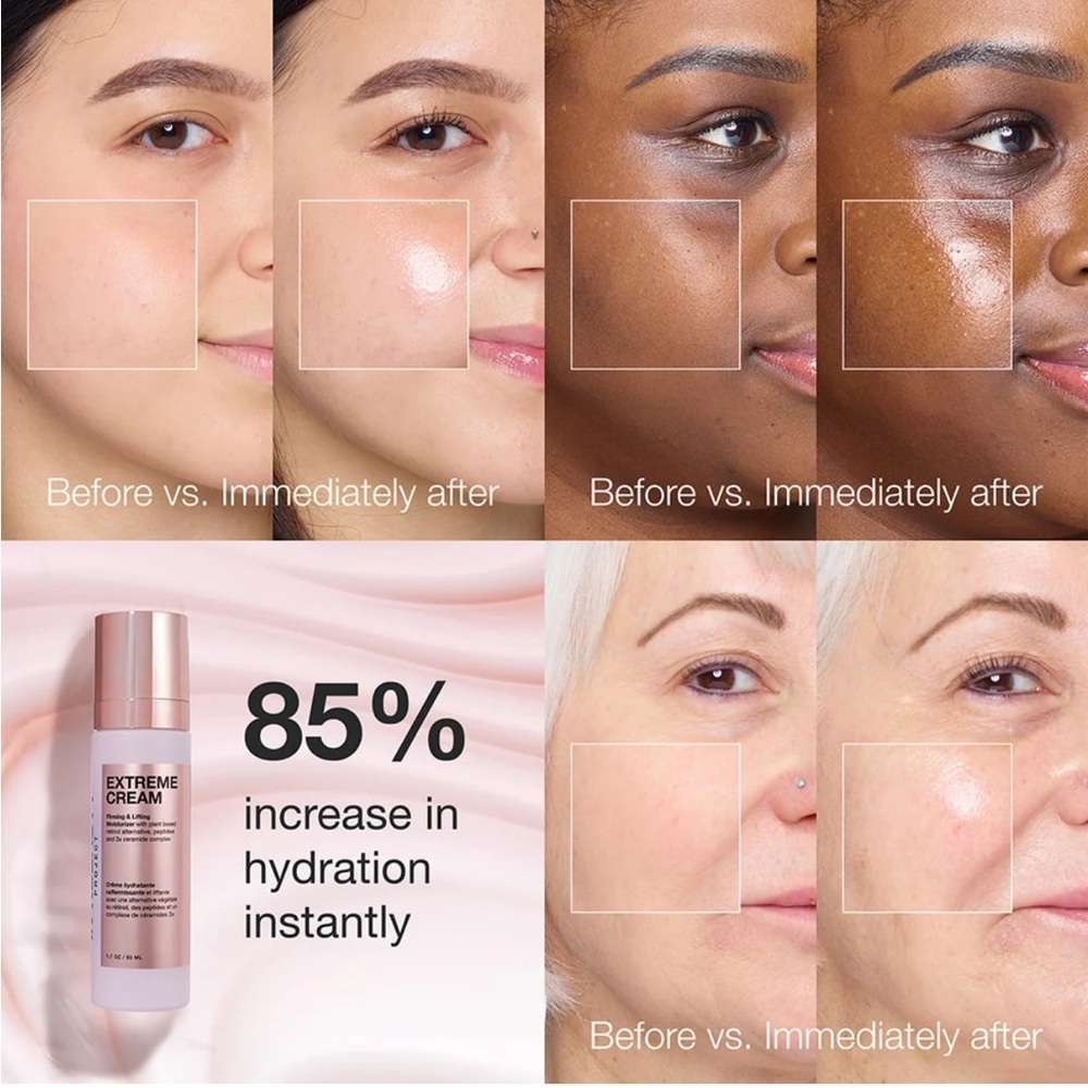 INNBeauty Extreme Cream Firming & Lifting - Picture 5 of 11
